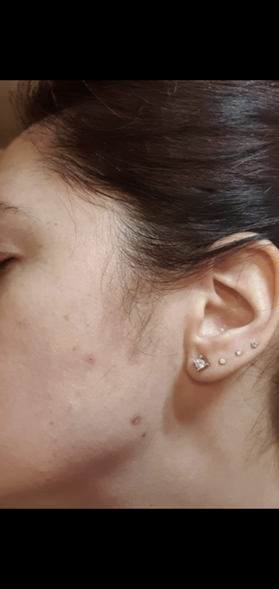 La Saponaria Niacinamide Zinco Siero Viso 30 ml Pelli Impure